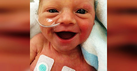 Le sourire éblouissant d’un bébé prématuré donne espoir à des milliers de parents inquiets